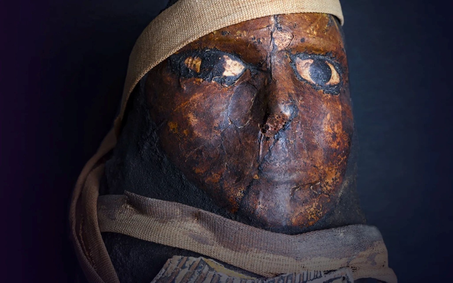 © Musée de l'Homme